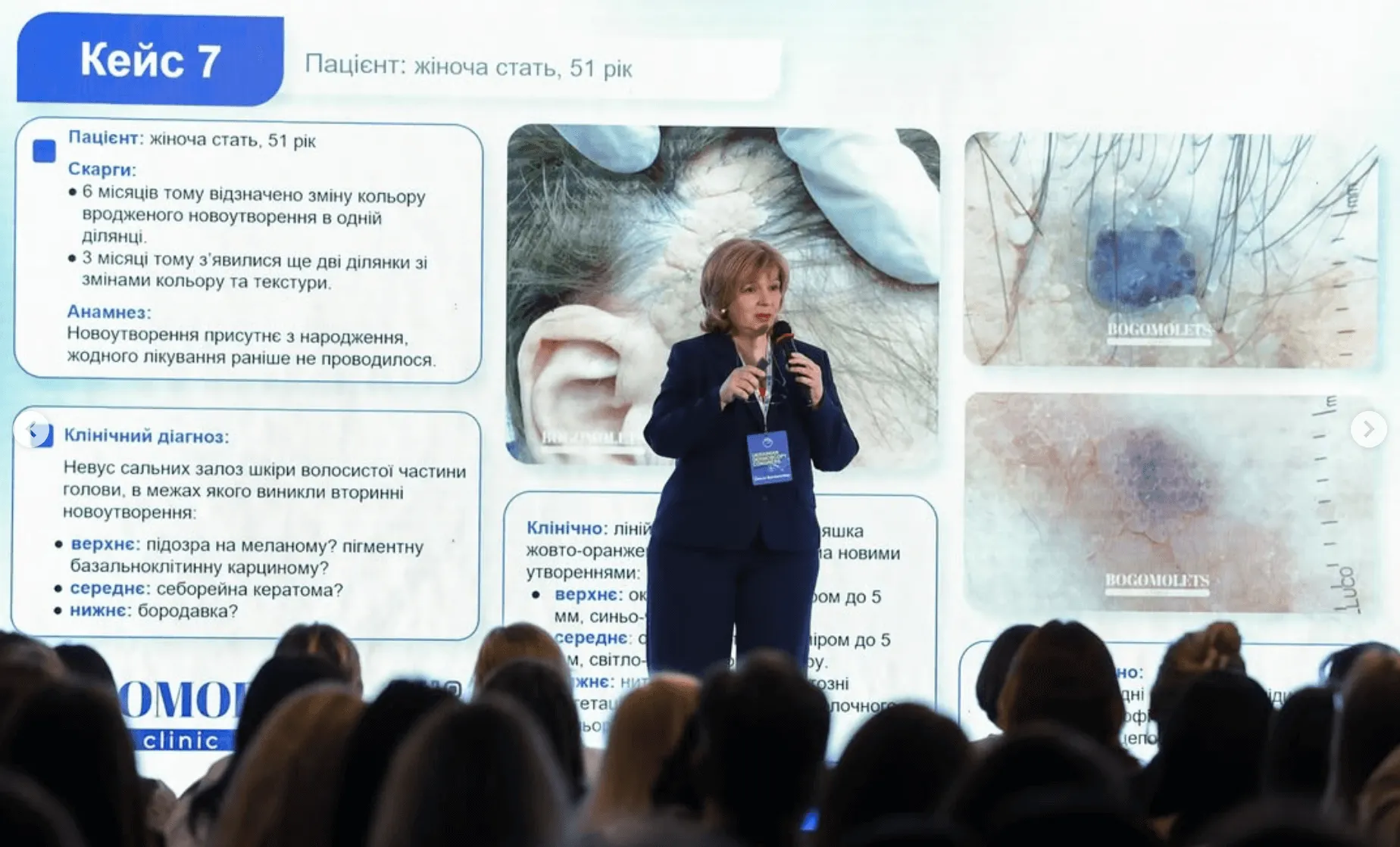 Лікарі BOGOMOLETS CLINIC прийняли участь у дерматологічному конгресі UDC VIII